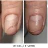 NAILSOFTHEDAY OniStop Масло для лечения онихолизиса, 15 мл