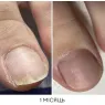 NAILSOFTHEDAY OniStop Олійка для лікування оніхолізісу, 15 мл